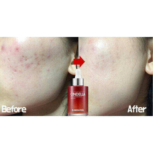 Medi-Peel Антиоксидантная мульти-сыворотка Cindella Multi-Antioxidant Ampoule 100мл — изображение 5